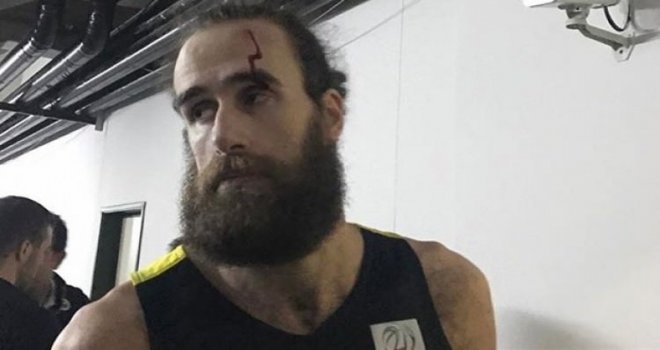 Datome'nin alnı yarıldı...